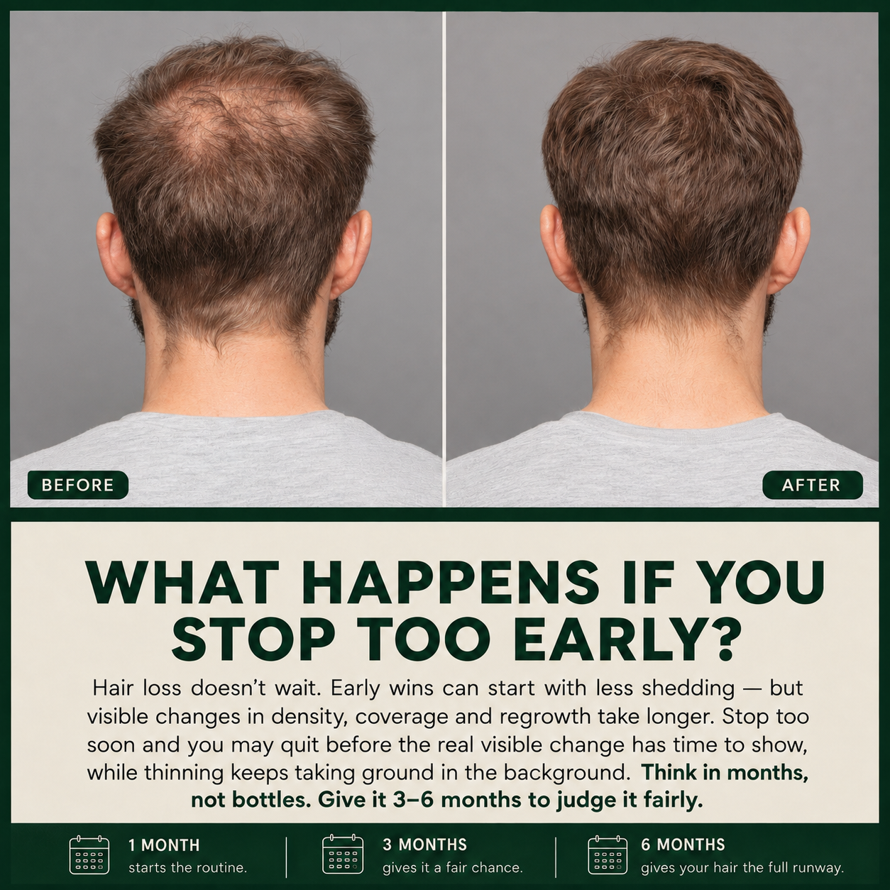 BUSHBUSH™ - Hair Regrowth System