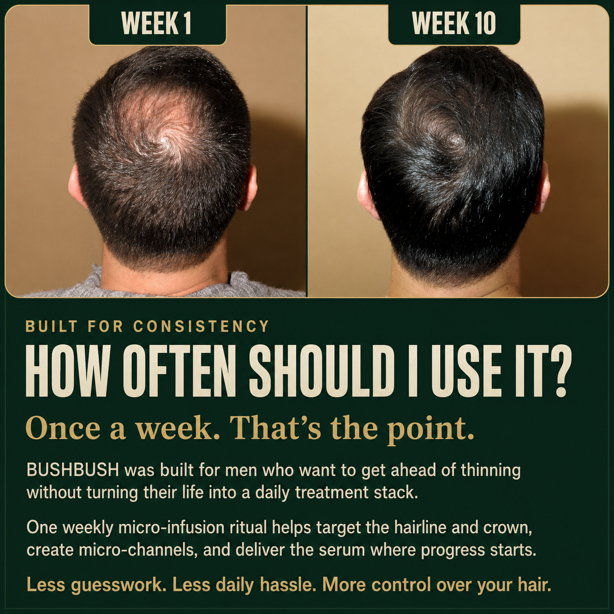 BUSHBUSH™ - Hair Regrowth System